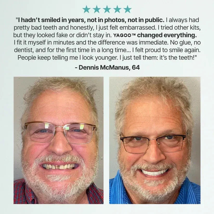 🌎Ends Today: 70% OFF! ⏰ Medical Full Denture with Strong Suction