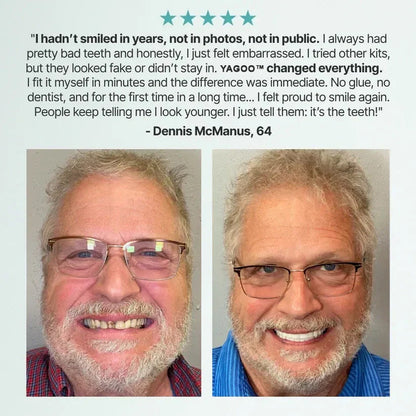 🌎Ends Today: 70% OFF! ⏰ Medical Full Denture with Strong Suction
