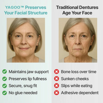 🌎Ends Today: 70% OFF! ⏰ Medical Full Denture with Strong Suction