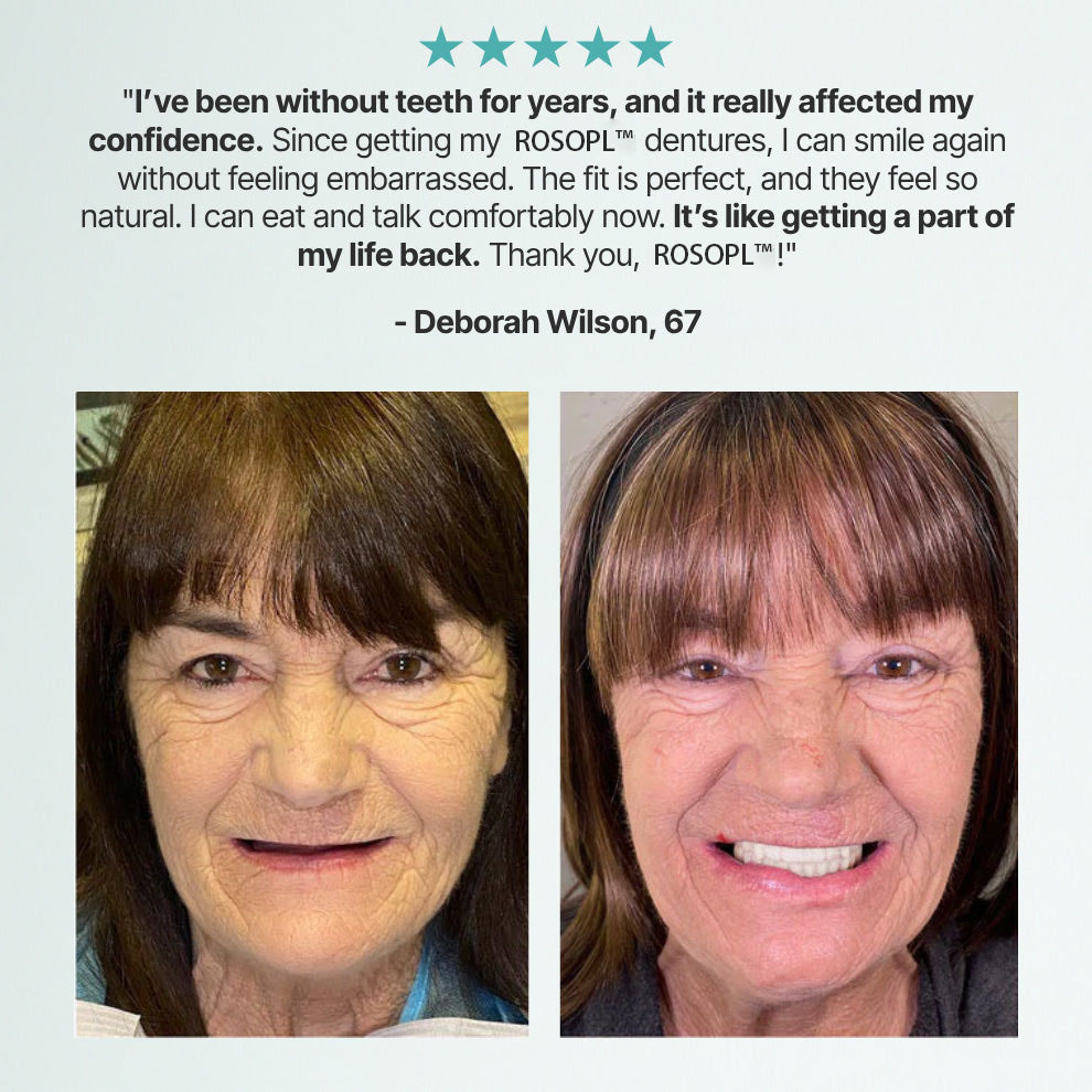 🌎Ends Today: 70% OFF! Custom-Fit Full Functional DenturesMake you more confident